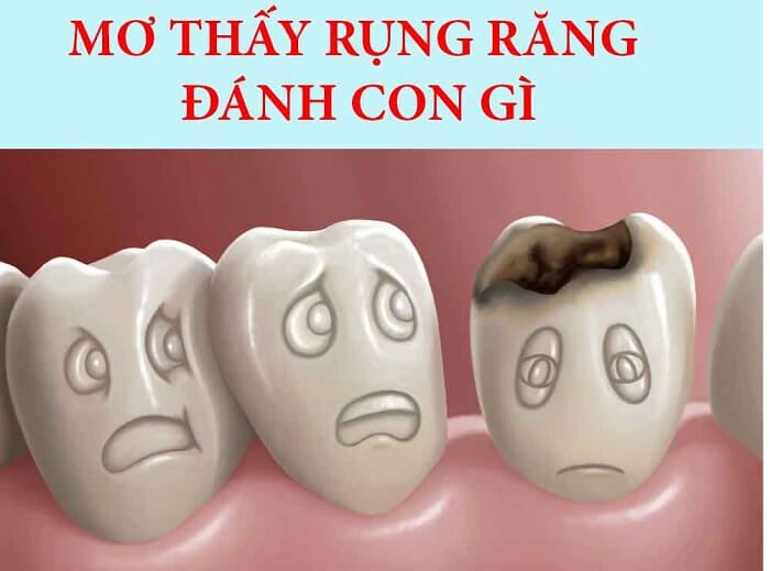 Nằm mơ thấy rụng răng chốt đề số mấy? 